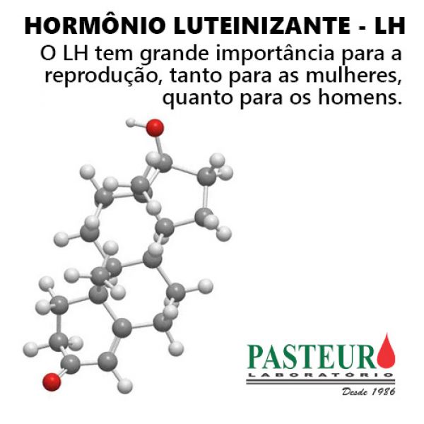  Hormônio Luteinizante - LH