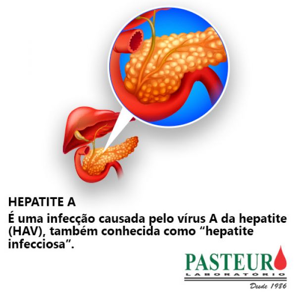 Hepatite A