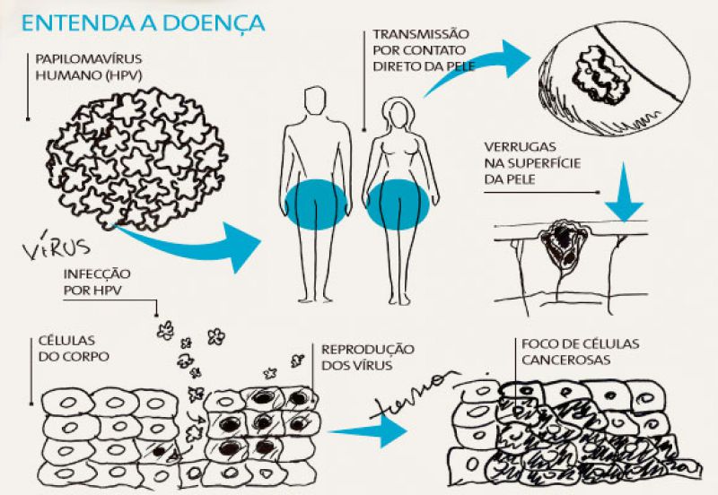 HPV: tudo sobre a doença e a vacina