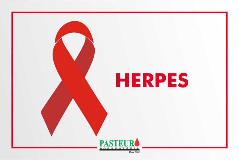 Herpes-zóster