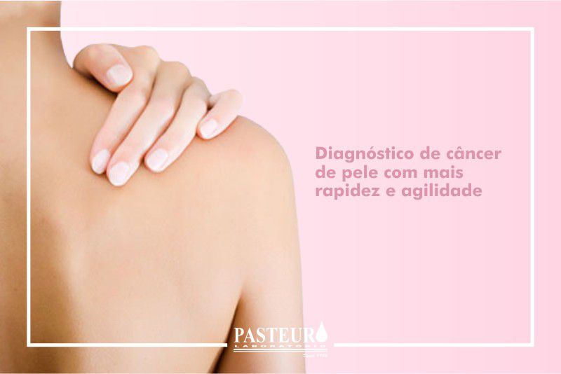 Diagnóstico de câncer de pele com mais rapidez e agilidade