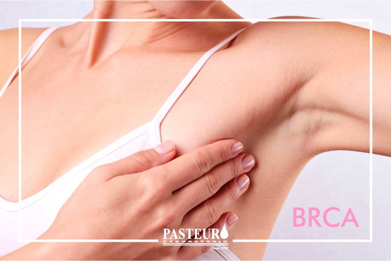 BRCA: Um novo exame laboratorial na prevenção do Câncer em Mulheres