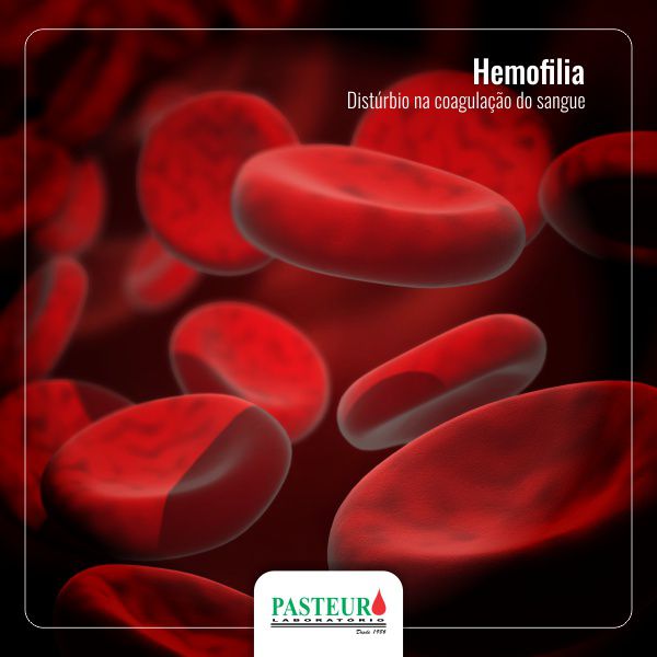 Hemofilia