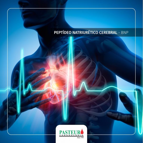  Peptídeo Natriurético Cerebral - BNP