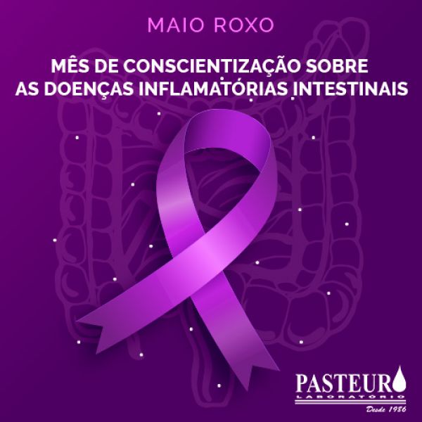  Maio Roxo