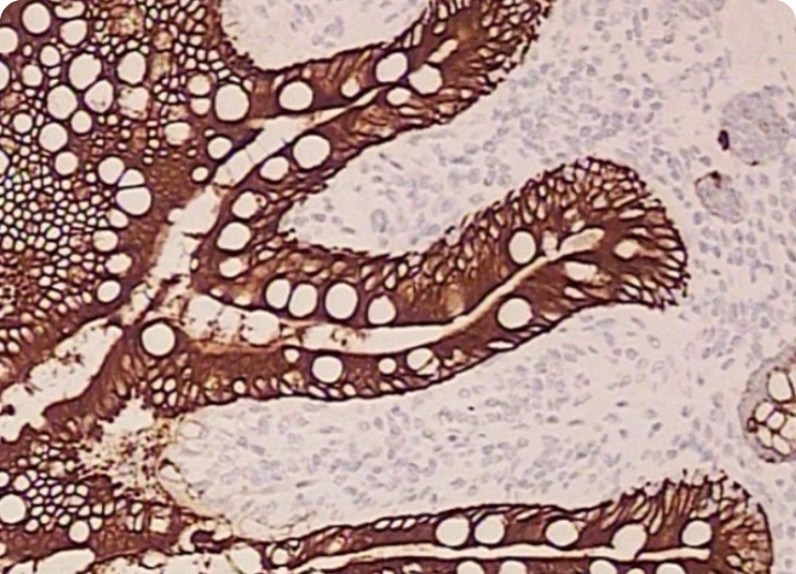 Estudo Imunohistoquímico